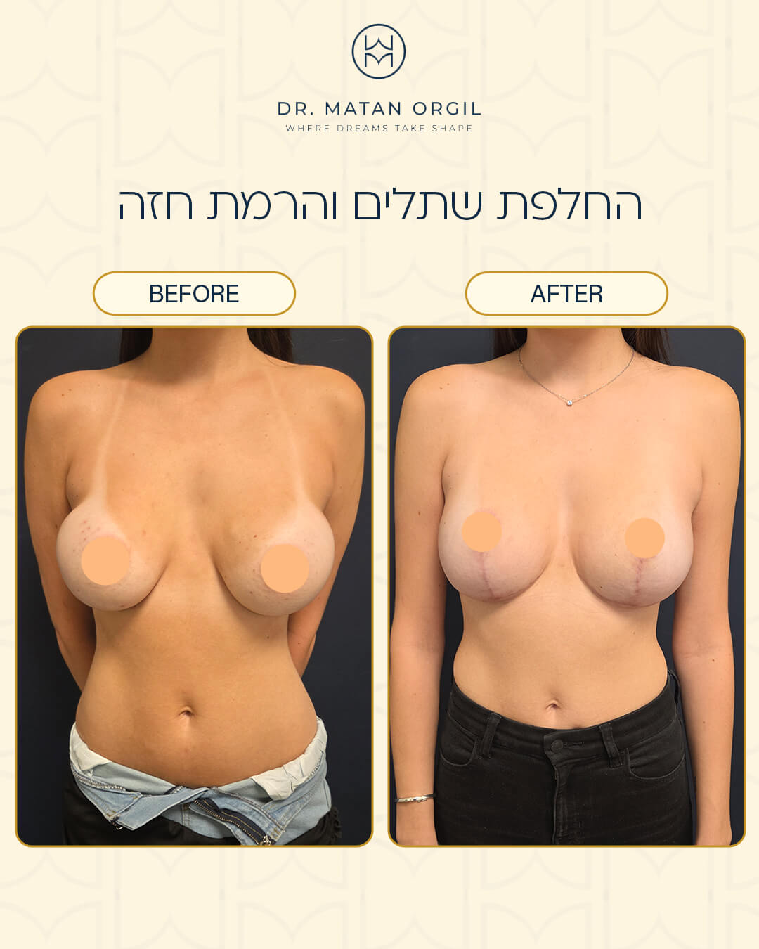 תוצאת טיפול אסתטי 1